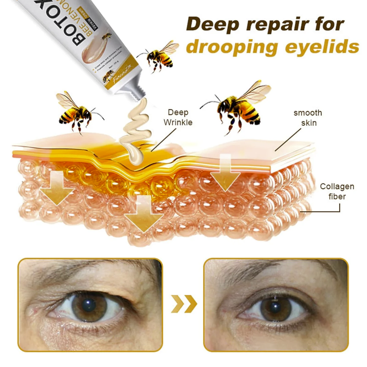 BeeTox™ ✨ Wrinkle Repair Bee Venom Rejuvenating Cream🐝🍯(Buy 1 Get 1 Free🔥🔥)