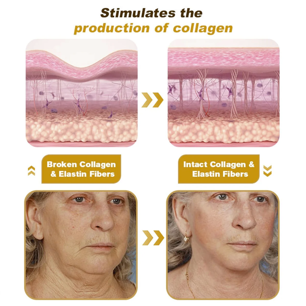 BeeTox™ ✨ Wrinkle Repair Bee Venom Rejuvenating Cream🐝🍯(Buy 1 Get 1 Free🔥🔥)